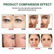 Anti Aging Essences For Moisturizing, Firming Brightening